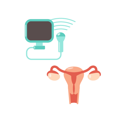 Radiofrecuencia vaginal